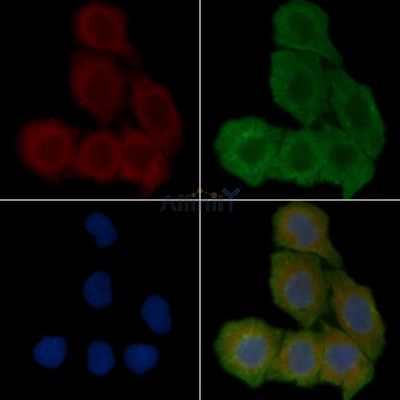 FGF5 Antibody - DF2496 staining Hela cells(30min of UV treatment) by IF/ICC.