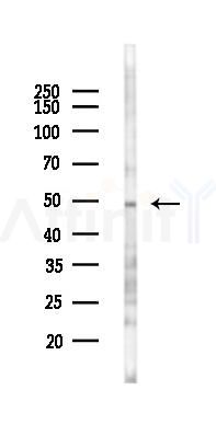IL17RB Antibody - Western blot analysis of lysates from COLO205 cells(starvation 24h treatment), using IL17RB Antibody at 1/1000 dilution.