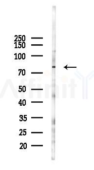IL17RD Antibody - Western blot analysis of lysates from B16F10-LUC cells(heat-shock 45min treatment), using IL17RD Antibody at 1/1000 dilution.