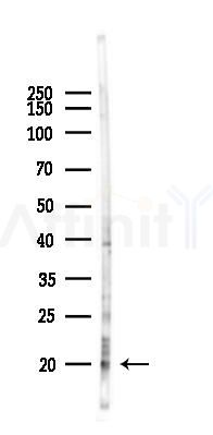 IGF2 Antibody - Western blot analysis of lysates from B16F10-LUC cells(heat-shock 45min treatment), using IGF2 Antibody at 1/1000 dilution.