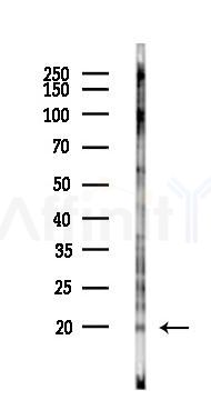 IL7 Antibody - Western blot analysis of lysates from COLO205 cells(starvation 24h treatment), using IL7 Antibody at 1/1000 dilution.