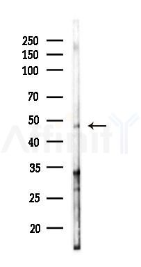 PAX8 Antibody - Western blot analysis of lysates from A2780 cells(LPS 4h treatment), using PAX8 Antibody at 1/1000 dilution.
