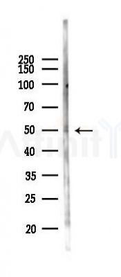 SOX4 Antibody - Western blot analysis of lysates from B16F10-LUC cells(heat-shock 45min treatment), using SOX4 Antibody at 1/1000 dilution.