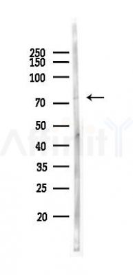 Cytochrome P450 reductase Antibody - Western blot analysis of lysates from Hela cells(starvation 24h treatment), using Cytochrome P450 reductase Antibody at 1/1000 dilution.