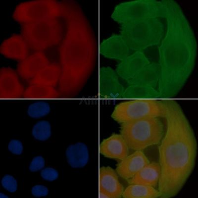 Cytochrome P450 3A43 Antibody - DF2617 staining Hela cells(30min of UV treatment) by IF/ICC.