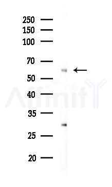 Cytochrome P450 17A1 Antibody - Western blot analysis of lysates from A2780 cells(LPS 4h treatment), using Cytochrome P450 17A1 Antibody at 1/1000 dilution.