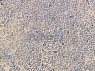 MKK7 Antibody - DF2638 at 1/100 staining human normal tonsil tissue by IHC-P.