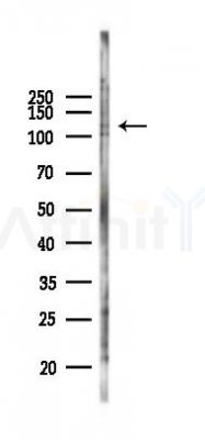 RASA1 Antibody - Western blot analysis of lysates from B16F10-LUC cells(heat-shock 45min treatment), using RASA1 Antibody at 1/1000 dilution.