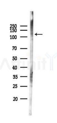 RASA1 Antibody - Western blot analysis of lysates from Hela cells(starvation 24h treatment), using RASA1 Antibody at 1/1000 dilution.