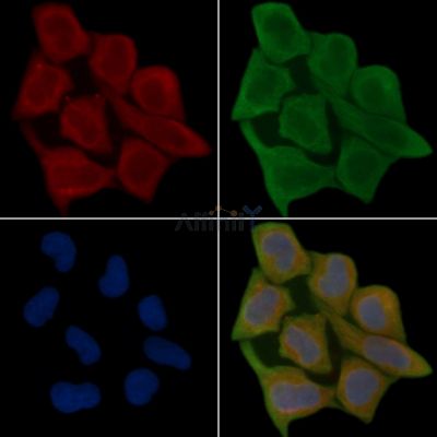 RASA1 Antibody - DF2645 staining Hela cells(45min of heat-shock treatment) by IF/ICC.