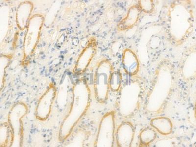 POMC Antibody - DF2655 at 1/100 staining human normal kidney tissue by IHC-P.