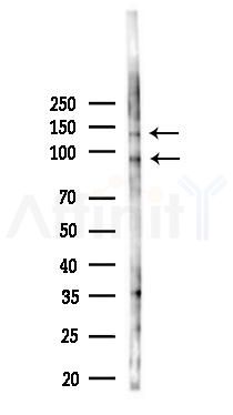DDR2 Antibody - Western blot analysis of lysates from 293 cells(LPS 4h treatment), using DDR2 Antibody at 1/1000 dilution.