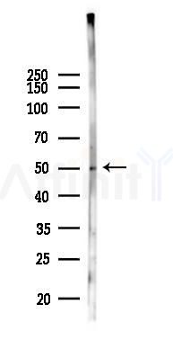 IRAK4 Antibody - Western blot analysis of lysates from B16F10-LUC cells(heat-shock 45min treatment), using IRAK4 Antibody at 1/1000 dilution.