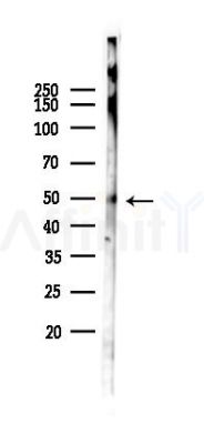 IRAK4 Antibody - Western blot analysis of lysates from Mouse testis, using IRAK4 Antibody at 1/1000 dilution.