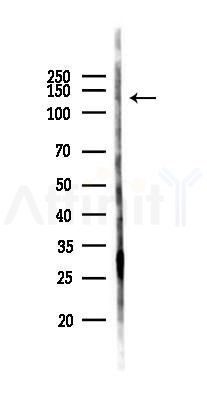 TYRO3 Antibody - Western blot analysis of lysates from Hela cells(starvation 24h treatment), using TYRO3 Antibody at 1/1000 dilution.