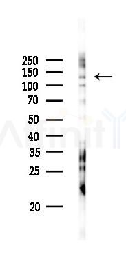 TAO2 Antibody - Western blot analysis of lysates from PC12 cells(LPS 4h treatment), using TAO2 Antibody at 1/1000 dilution.