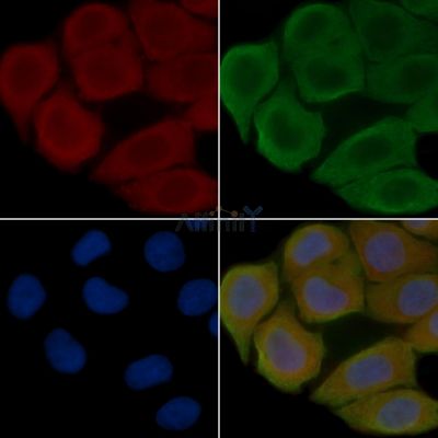 Peroxiredoxin 1 Antibody - DF2700 staining Hela cells(30min of UV treatment) by IF/ICC.