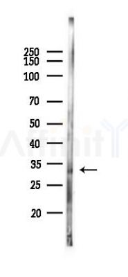 CCR2 Antibody - Western blot analysis of lysates from Hela cells(starvation 24h treatment), using CCR2 Antibody at 1/1000 dilution.