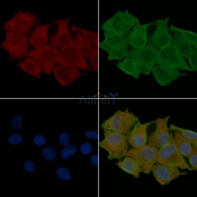 CMKLR1 Antibody - DF2712 staining Hela cells(24h of starvation treatment) by IF/ICC.