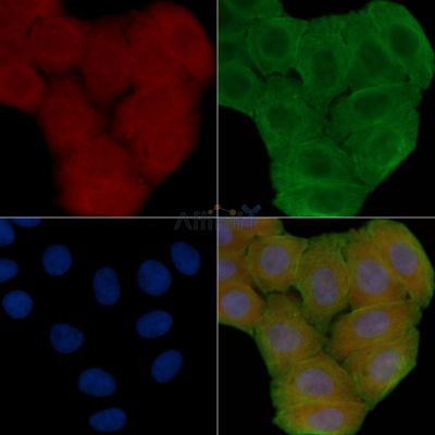 GPR25 Antibody - DF2733 staining Hela cells(30min of UV treatment) by IF/ICC.