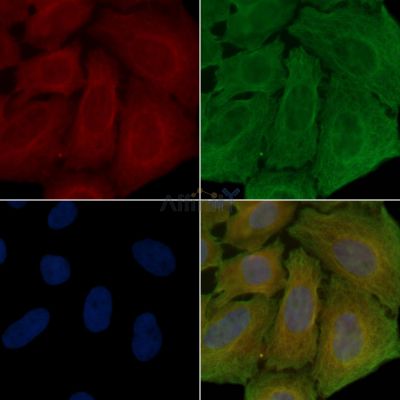 GPR48 Antibody - DF2749 staining Hela cells(30min of UV treatment) by IF/ICC.