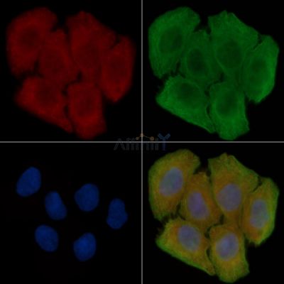 GPR52 Antibody - DF2750 staining Hela cells(30min of UV treatment) by IF/ICC.