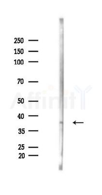 GPR62 Antibody - Western blot analysis of lysates from Rat liver, using GPR62 Antibody at 1/1000 dilution.