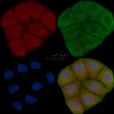 GPR86/GPR94 Antibody - DF2770 staining Hela cells(30min of UV treatment) by IF/ICC.