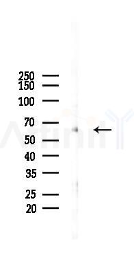 GPR97 Antibody - Western blot analysis of lysates from PC12 cells(LPS 4h treatment), using GPR97 Antibody at 1/1000 dilution.