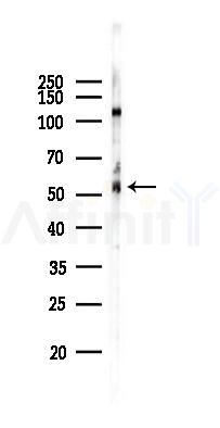 SS3R Antibody - Western blot analysis of lysates from B16F10-LUC cells(heat-shock 45min treatment), using SS3R Antibody at 1/1000 dilution.