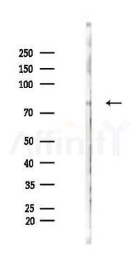 CHRM3 Antibody - Western blot analysis of lysates from Rat liver, using CHRM3 Antibody at 1/1000 dilution.
