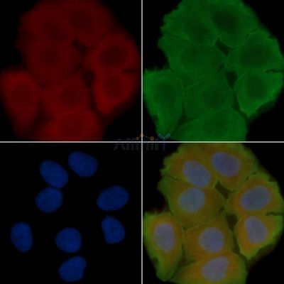 EDG8 Antibody - DF2787 staining Hela cells(30min of UV treatment) by IF/ICC.