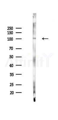F4/80 Antibody - Western blot analysis of lysates from K562 cells(starvation 24h treatment), using F4/80 Antibody at 1/1000 dilution.