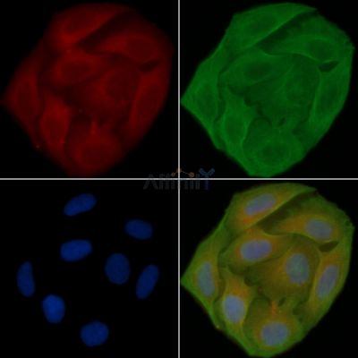 CCKBR Antibody - DF2793 staining Hela cells(30min of UV treatment) by IF/ICC.