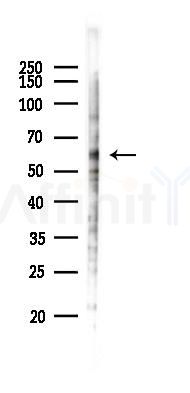 GPR176 Antibody - Western blot analysis of lysates from B16F10-LUC cells(heat-shock 45min treatment), using GPR176 Antibody at 1/1000 dilution.