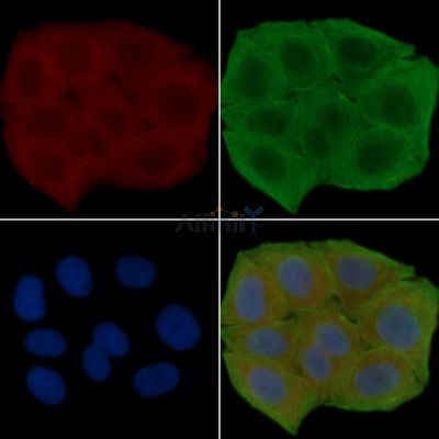 GPR45 Antibody - DF2808 staining Hela cells(30min of UV treatment) by IF/ICC.
