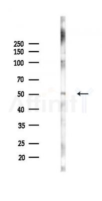 GRPR Antibody - Western blot analysis of lysates from K562 cells(starvation 24h treatment), using GRPR Antibody at 1/1000 dilution.