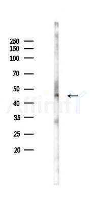 GRPR Antibody - Western blot analysis of lysates from B16F10-LUC cells(starvation 24h treatment), using GRPR Antibody at 1/1000 dilution.