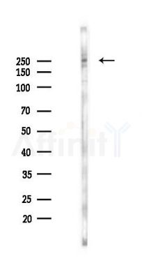 Lrp2 / Megalin Antibody - Western blot analysis of lysates from K562 cells(starvation 24h treatment), using Lrp2 / Megalin Antibody at 1/1000 dilution.