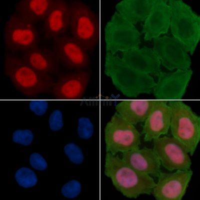 SAMHD1 Antibody - DF2987 staining Hela cells(30min of UV treatment) by IF/ICC.