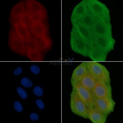 BCKD Antibody - DF3013 staining Hela cells(30min of UV treatment) by IF/ICC.