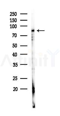 HGS Antibody - Western blot analysis of lysates from PC12 cells(LPS 4h treatment), using HGS Antibody at 1/1000 dilution.