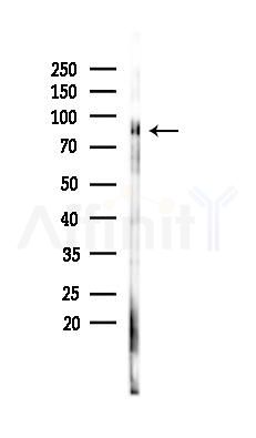 HGS Antibody - Western blot analysis of lysates from Rat testis, using HGS Antibody at 1/1000 dilution.