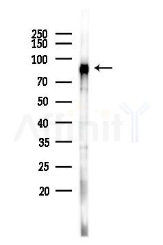 HGS Antibody - Western blot analysis of lysates from K562 cells(UV 30min treatment), using HGS Antibody at 1/1000 dilution.