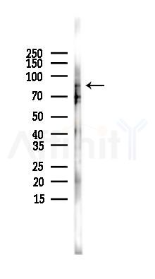 HGS Antibody - Western blot analysis of lysates from Mouse liver, using HGS Antibody at 1/1000 dilution.