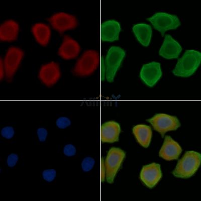 HGS Antibody - DF3015 staining Hela cells(45min of heat-shock treatment) by IF/ICC.