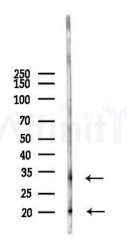 TNFSF15 Antibody - Western blot analysis of lysates from PC12 cells(LPS 4h treatment), using TNFSF15 Antibody at 1/1000 dilution.