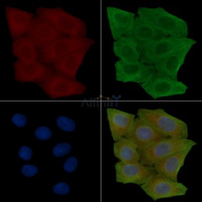 Adrenergic Receptor  alpha -2A Antibody - DF3076 staining Hela cells(30min of UV treatment) by IF/ICC.