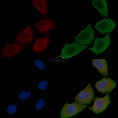 GLU2B Antibody - DF3092 staining Hela cells(30min of UV treatment) by IF/ICC.