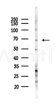 TCF3 Antibody - Western blot analysis of lysates from COLO205 cells(starvation 24h treatment), using TCF3 Antibody at 1/1000 dilution.